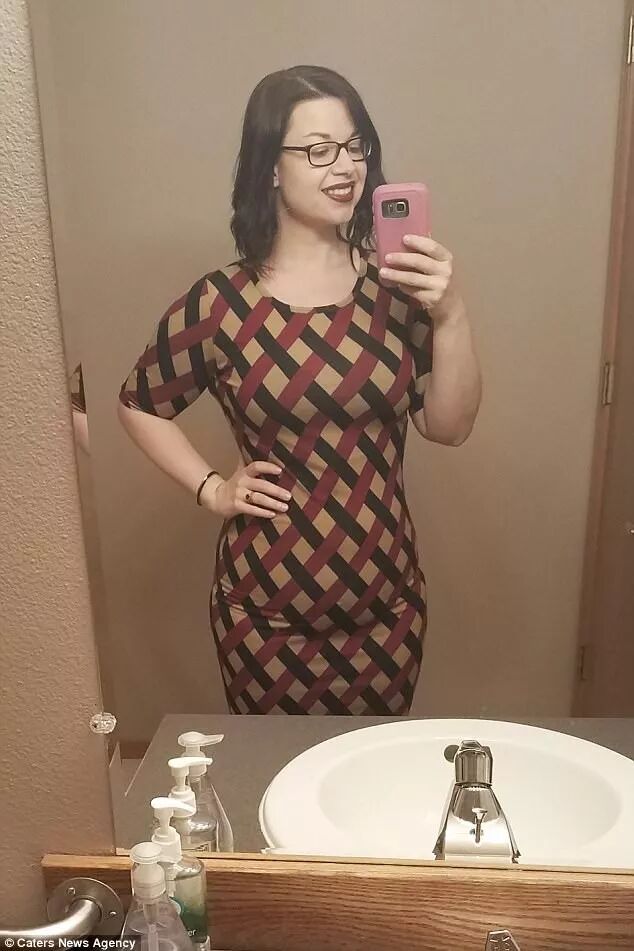 减肥手术多少钱_手术减肥_减肥手术后遗症