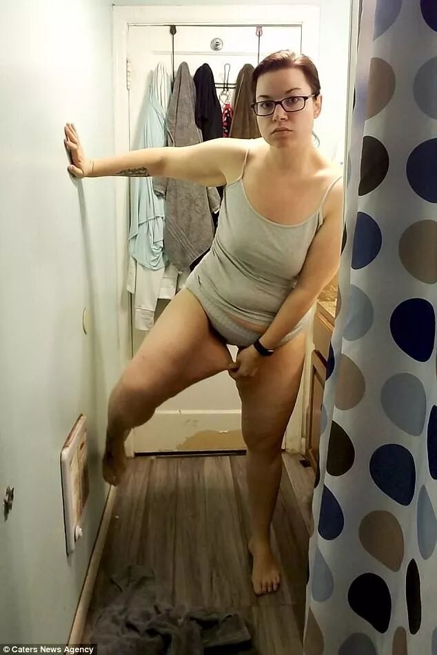 手术减肥_减肥手术多少钱_减肥手术后遗症