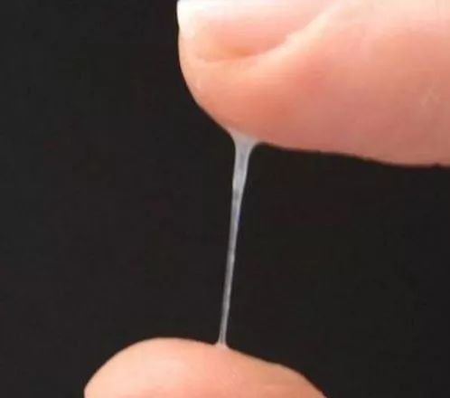 女人有这4种样子的白带,当心宫颈癌,现在防癌还来得及吐美女痰浓图片