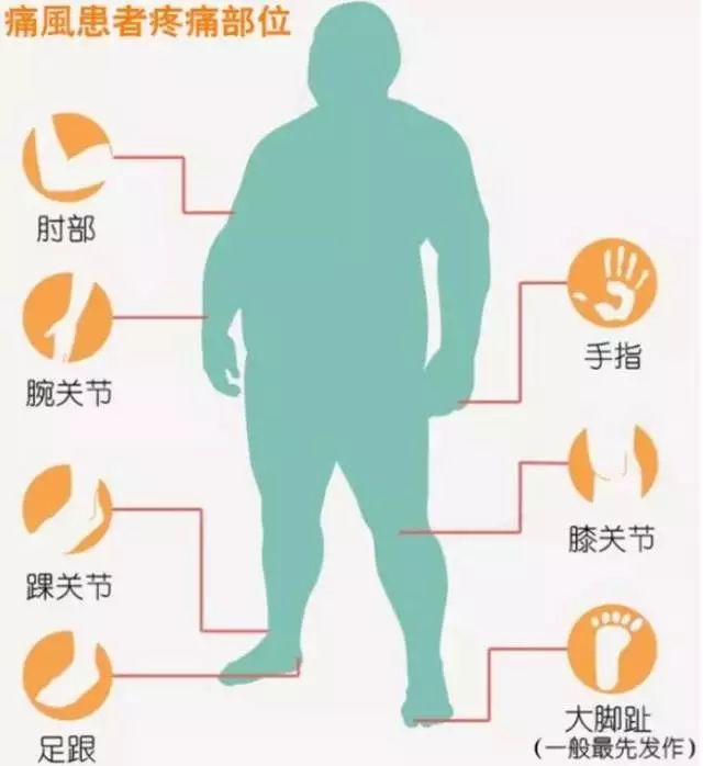 12岁小男孩脚疼,一查竟是痛风!原因出在平时这个小爱