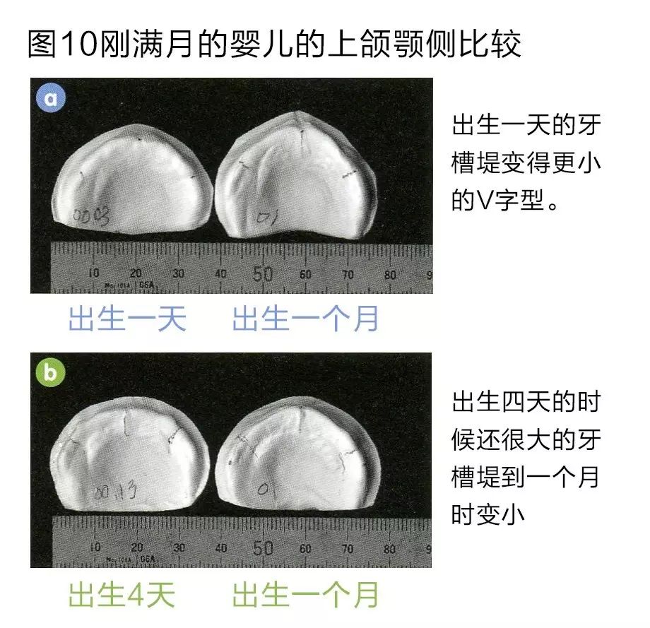 由于上颌颚侧是舌头