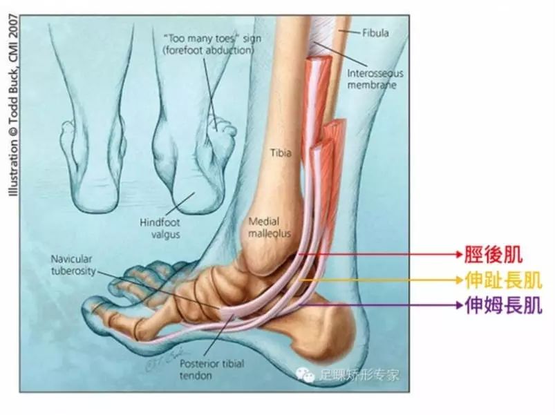 在内踝的下缘主要有三条肌腱经过,分别是胫后肌,屈趾长肌,以及屈拇长