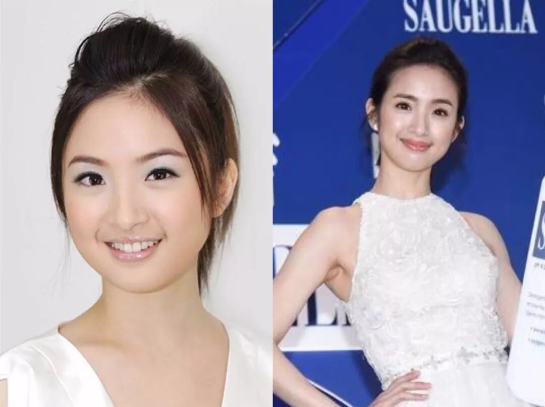大概是天生娃娃脸的缘故,林依晨似乎比其他女星更容易胖脸,但这几