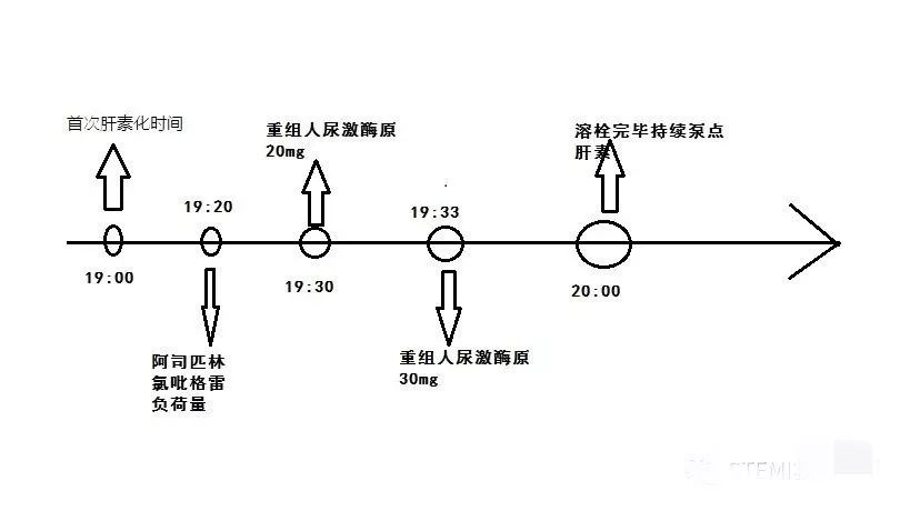 入院后溶栓时间节点