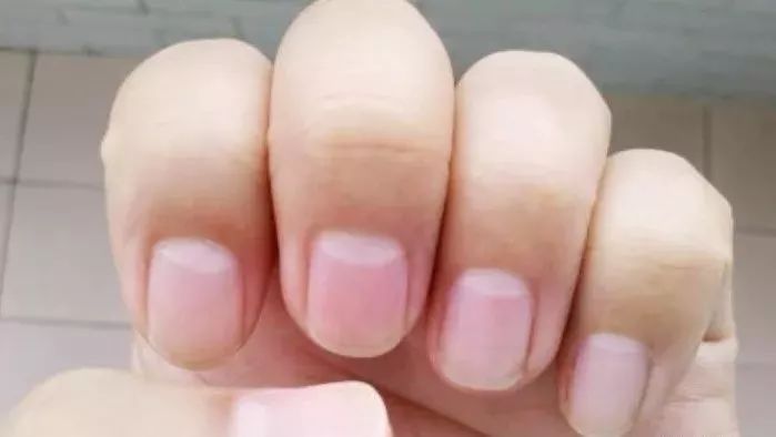 这里所说的"月牙"是从外表形状来看,弯弯的,位于手指甲的根部,看起来