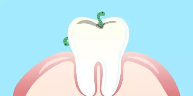 【口腔科普】有些补牙，为啥不能一次完成？