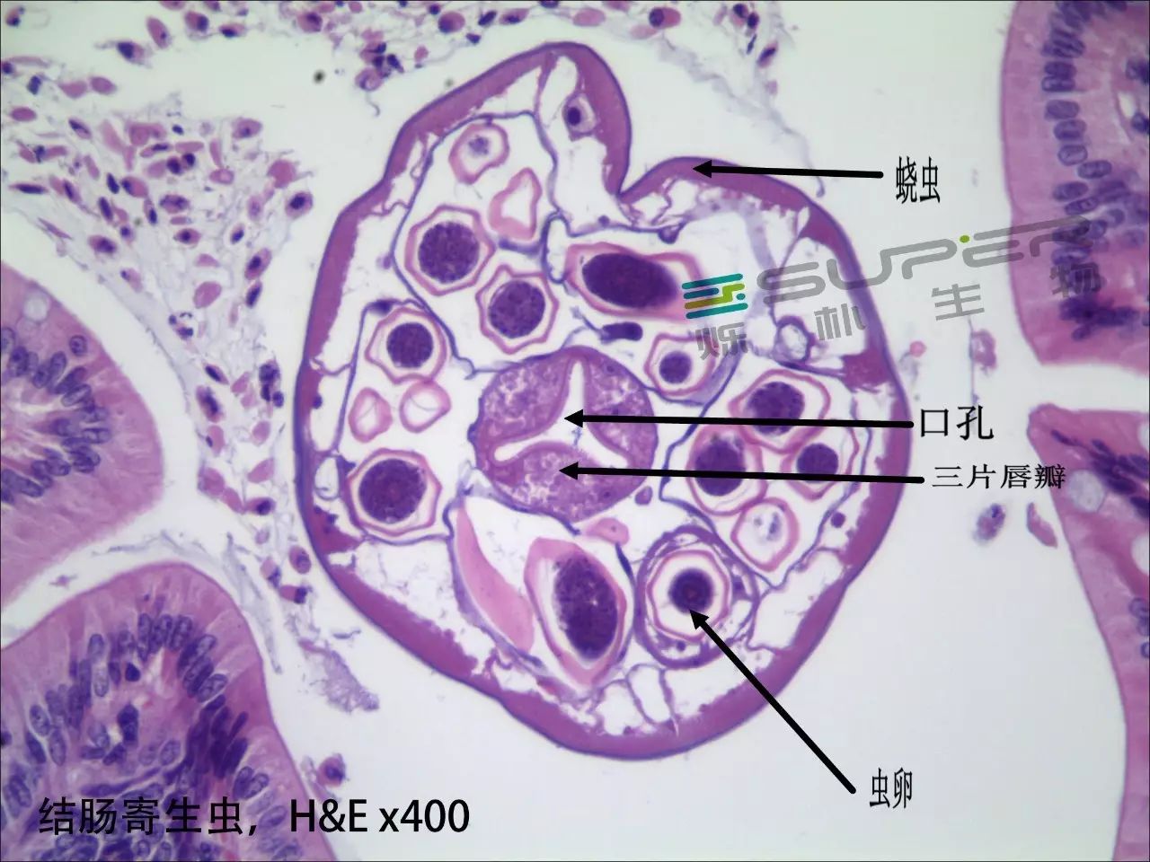 原生寄生虫或线虫出现在肠腔内,多见于大肠.