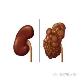 需要排毒的36种人！你中枪了吗？看过才知道