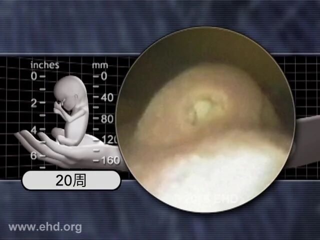 孩子部分⭐孕宝宝日历 | 怀孕19-20