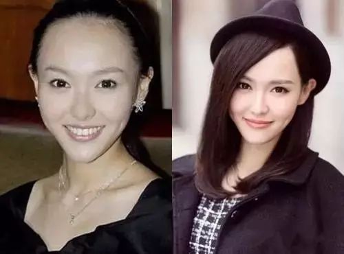 唐嫣的脑门大,锃亮的大额头占去了整张脸的一大半;留了刘海之后,发际