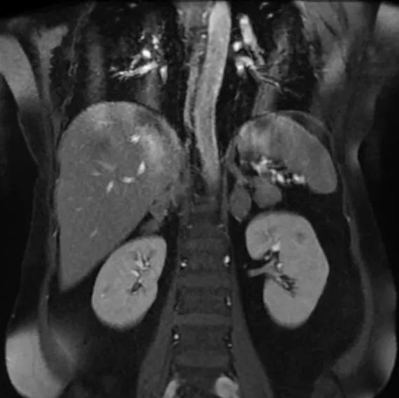cover_image
