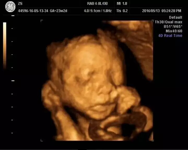 这不科学!瓜沥一位怀着二胎的妈妈说:我都不知道女人生孩子什么感觉……-怀孕期