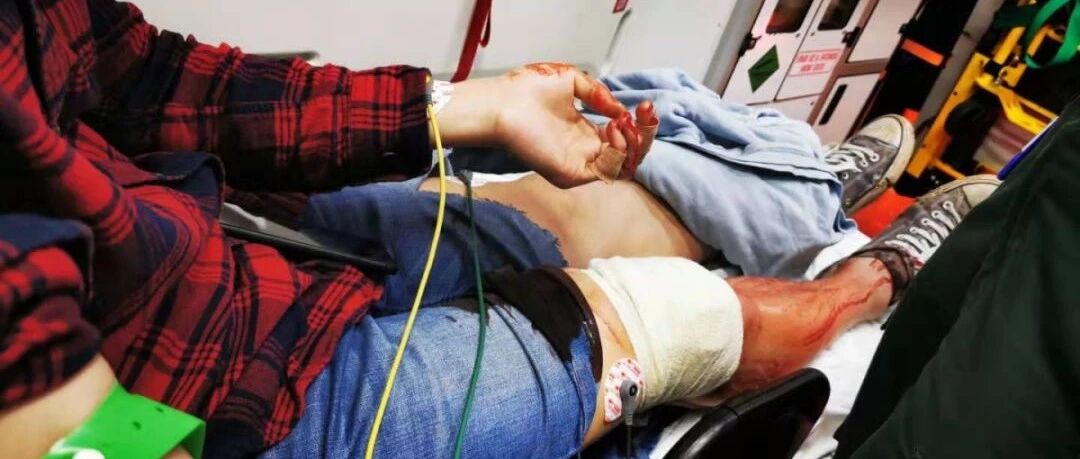 震惊！伯明翰留学生遇持刀抢劫被捅，流血不止！