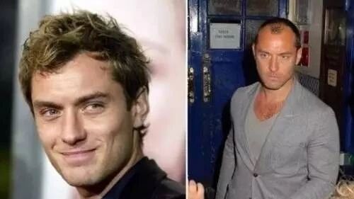 从群租到独居，从宅男到文青…留学腐国前VS后，太形象了！