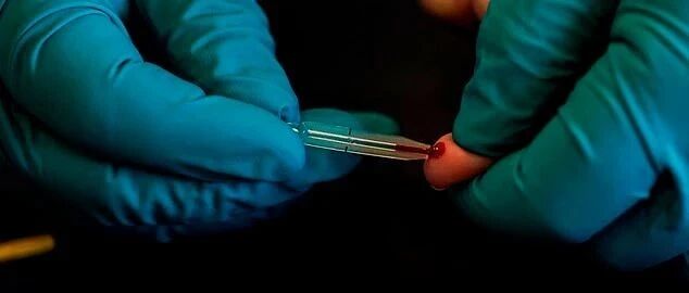 英国在哪里做血清IgM抗体测试? 亲测攻略十分钟出结果...