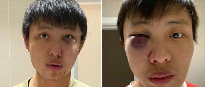 英国留学你可能没有因为歧视被打过，但是绝对经历过.....