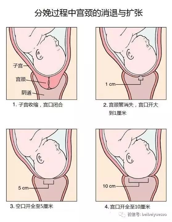 产科医生:顺产的优缺点,分娩的过程