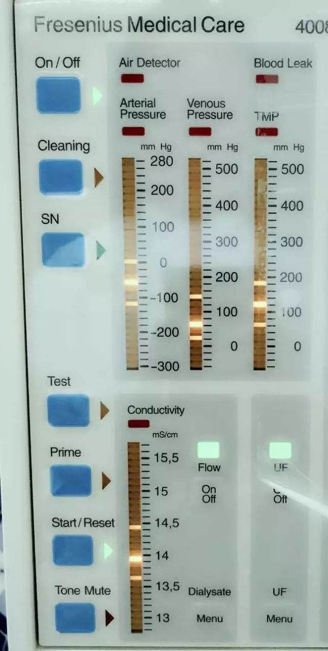 fresenius4008s常用英文注释