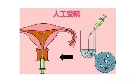 不孕症发生率上升,怀孕方法有三!快来看看!-怀孕期