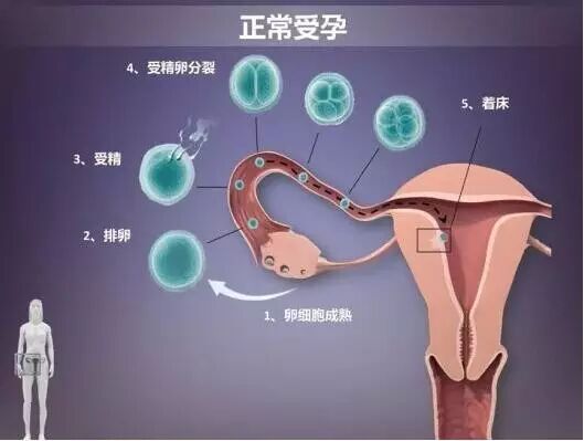 不孕症发生率上升,怀孕方法有三!快来看看!-怀孕期