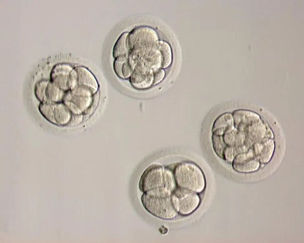 28岁赴美试管，移植的还是5AA胚胎，竟然也失败了？