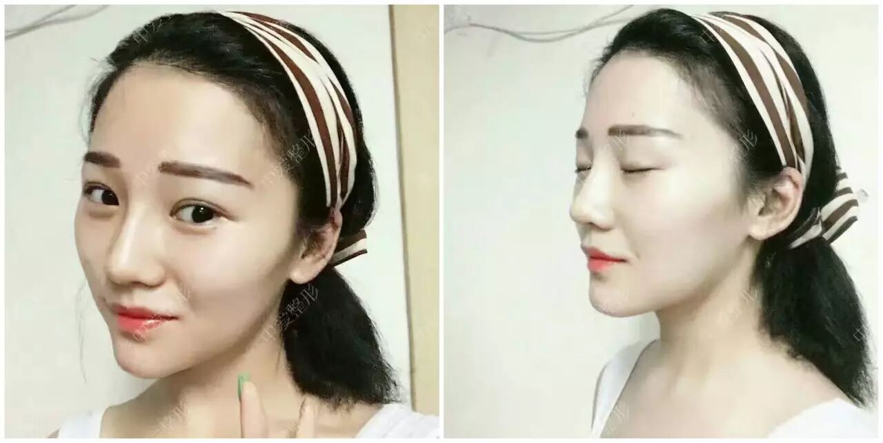 【中爱真人案例】