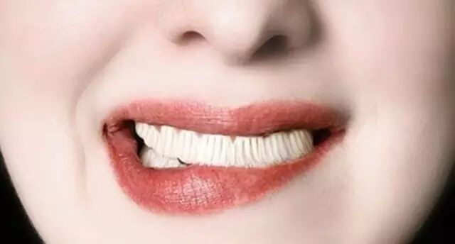 口腔溃疡来打扰，为你支几个小妙招！