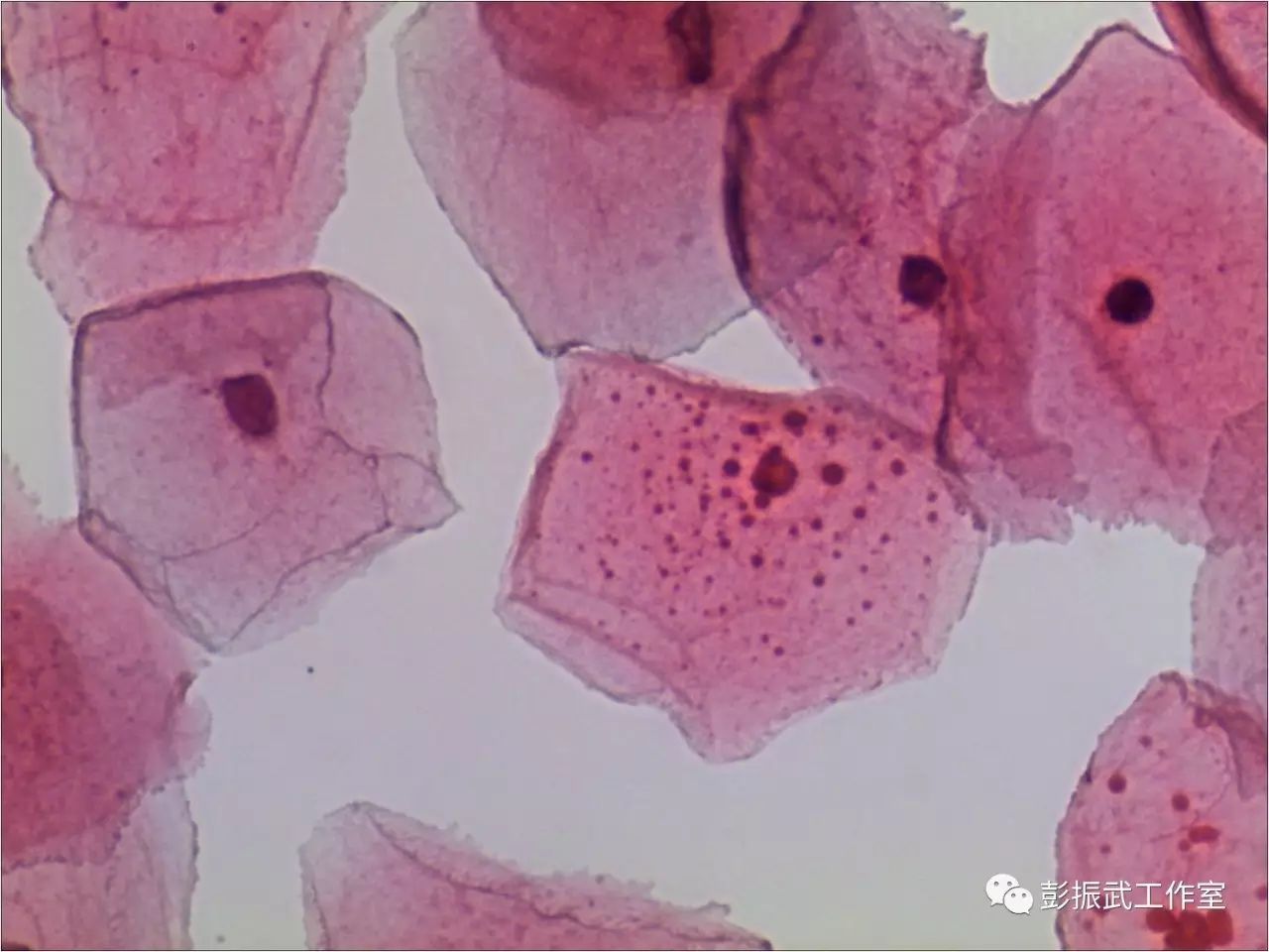 鳞状细胞基本形态