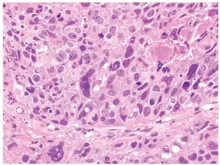 原来不是怀孕了!诊病比探案更扑朔迷离-怀孕期