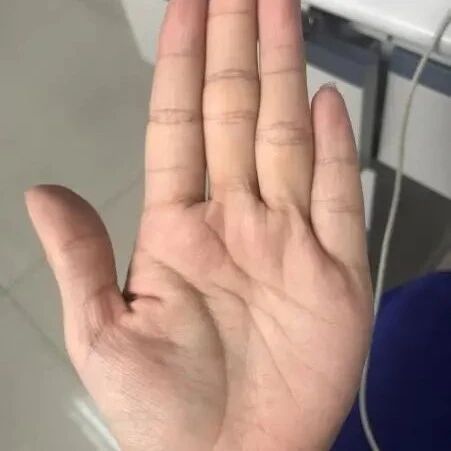 断掌手相：断掌女人的命运和化解