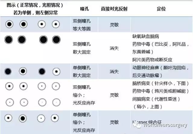 王子敬教授 瞳孔散大: 1.