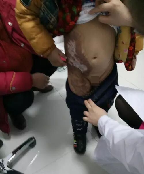 我的南阳贫困疤痕儿童义诊之行[tag]