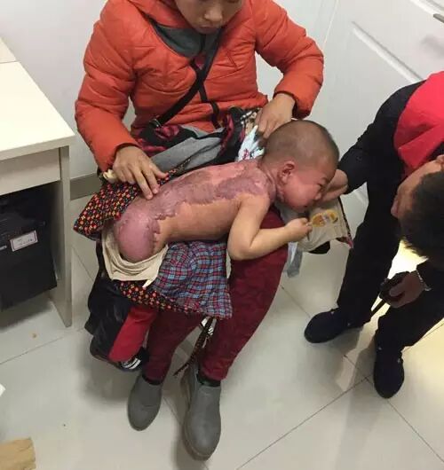 我的南阳贫困疤痕儿童义诊之行[tag]