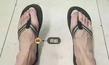 手上青筋越多,说明越~尤其是女性一定要看!