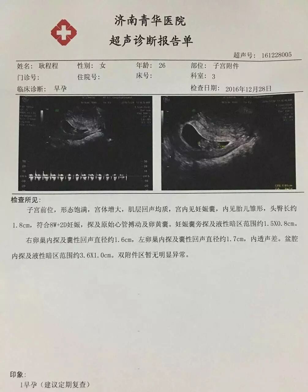 B超室传喜讯:3次胎停育,42岁的青华妈妈怀孕7w-怀孕期