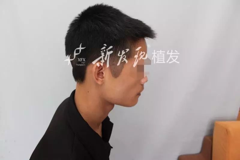 案例 你和型男之间还差一个好看的鬓角