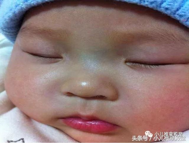 【小儿推拿】孩子发烧、咳嗽、扁桃体炎这3大病症，都一种手法效