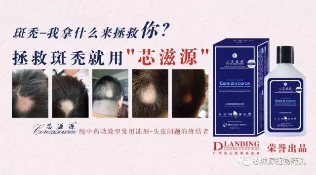 斑秃-我拿什么来拯救你？