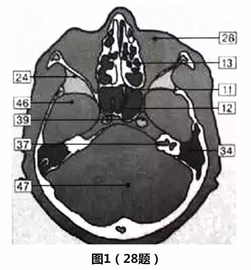 28.如图1所示,蝶窦的解剖位置是位于数字标示的(d)