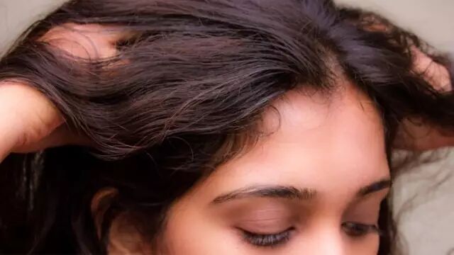 掉头发？你可能是头皮不健康