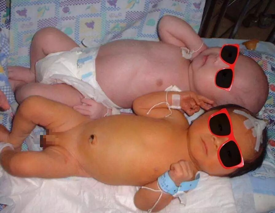 4006B光疗怎么用宝宝黄疸不用住院！深圳这家医院开日间光疗房，家长热捧_https://www.jmylbn.com_新闻资讯_第1张