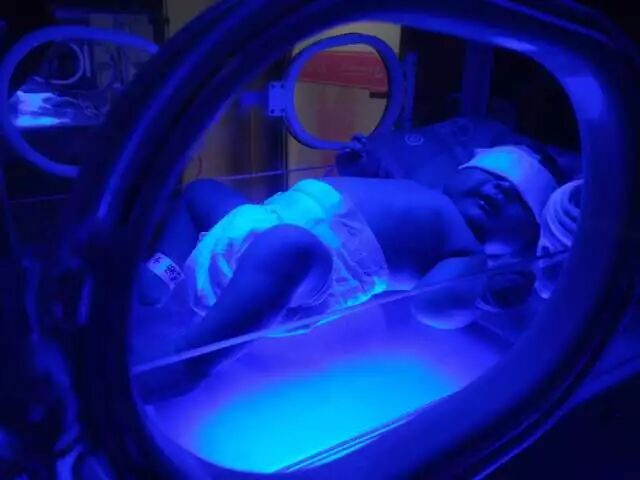 4006B光疗怎么用宝宝黄疸不用住院！深圳这家医院开日间光疗房，家长热捧_https://www.jmylbn.com_新闻资讯_第7张