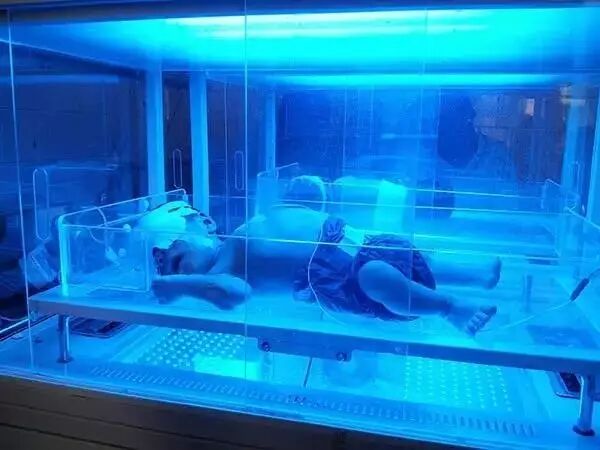 4006B光疗怎么用宝宝黄疸不用住院！深圳这家医院开日间光疗房，家长热捧_https://www.jmylbn.com_新闻资讯_第16张