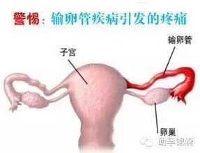 输卵管通而不畅的症状有哪些 可以怀孕吗-怀孕期