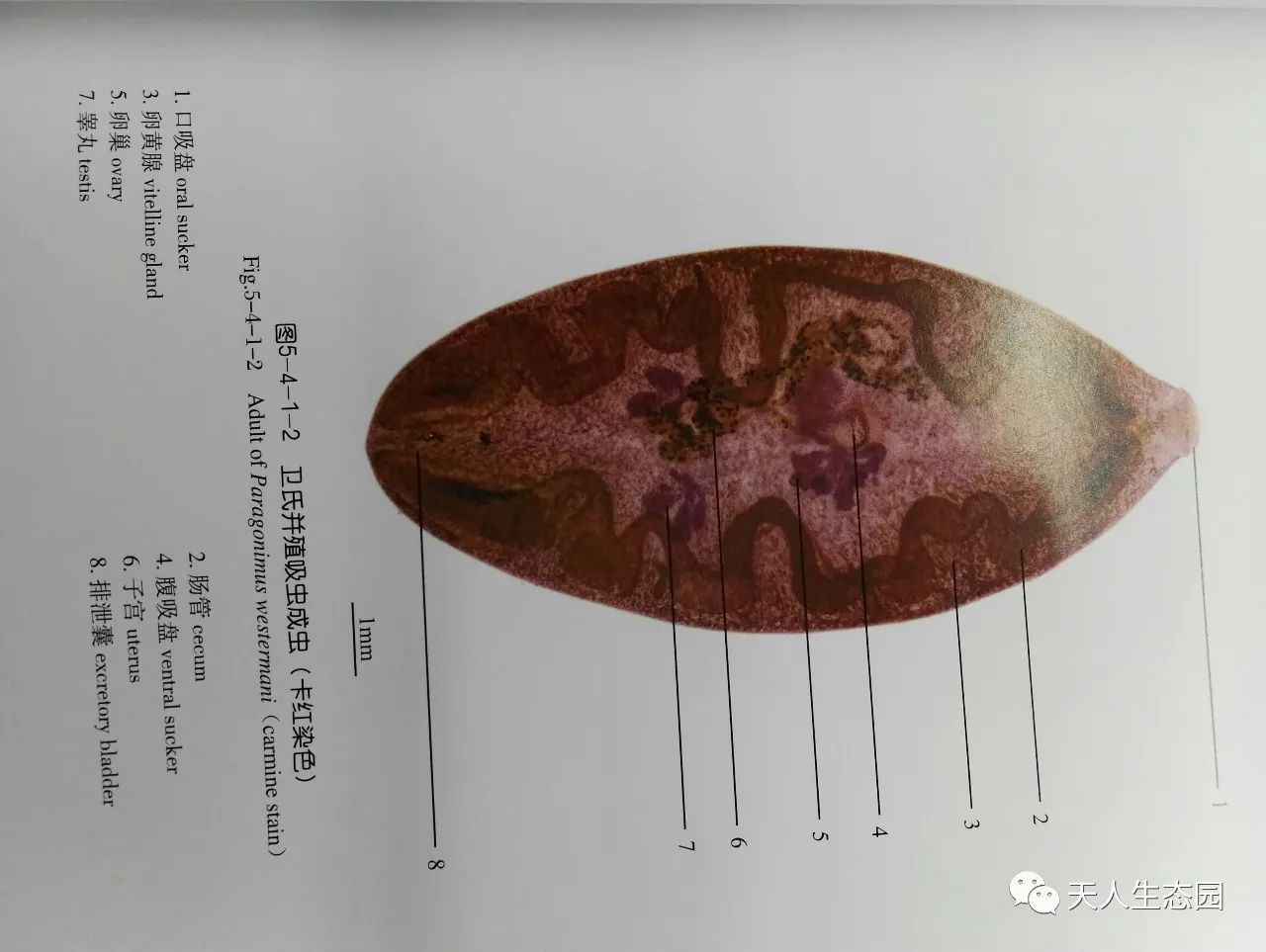 人体寄生虫系列之三 肺吸虫