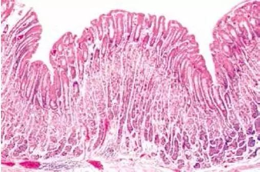 黏膜表面的小沟是固定的解剖学特征,称为胃区 一般组织学特征