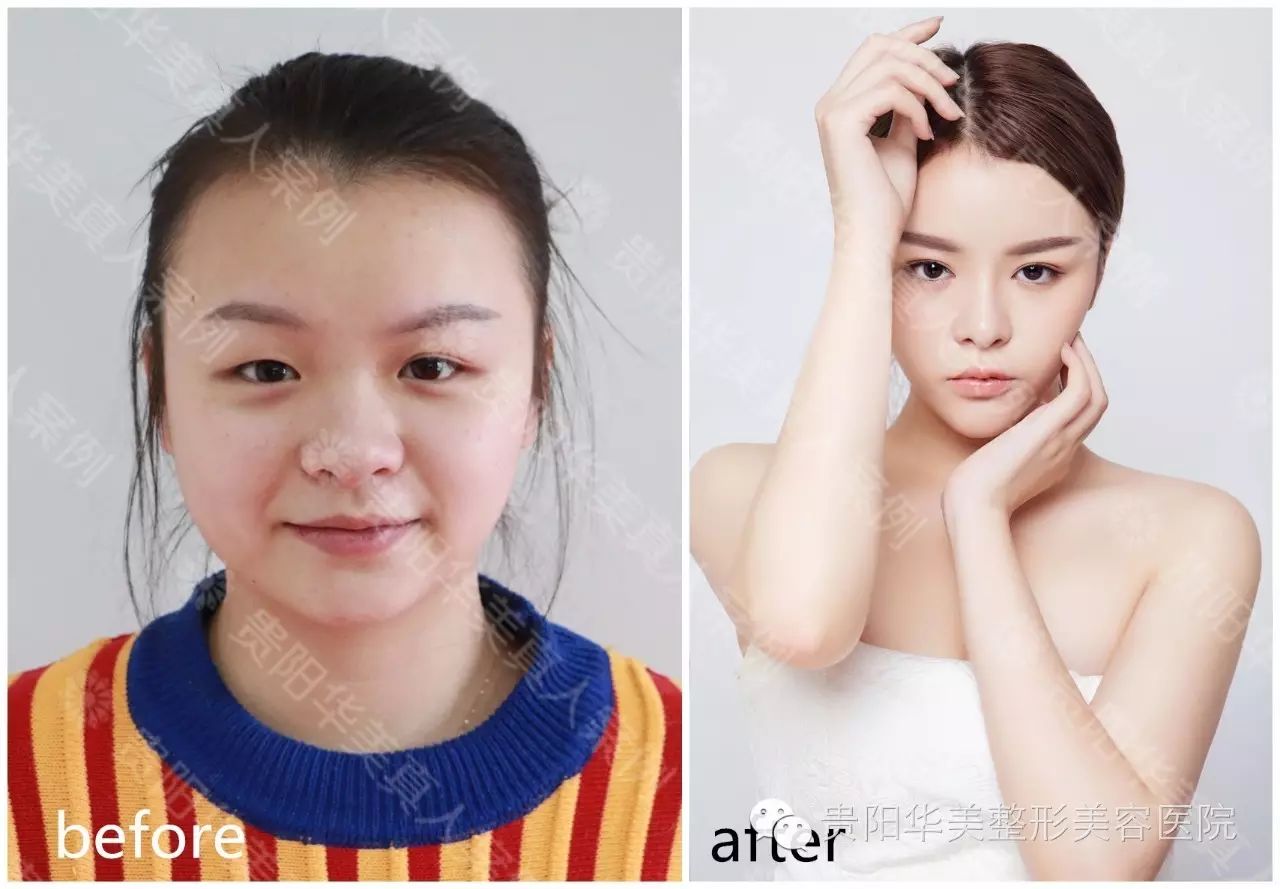 如何逆袭成为美鼻子女神呢? ▼ 当然是找到一位好专家啦!