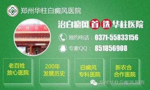 迈克尔杰克逊白癜风,多年的白癜风如何根治?,治疗白癜...