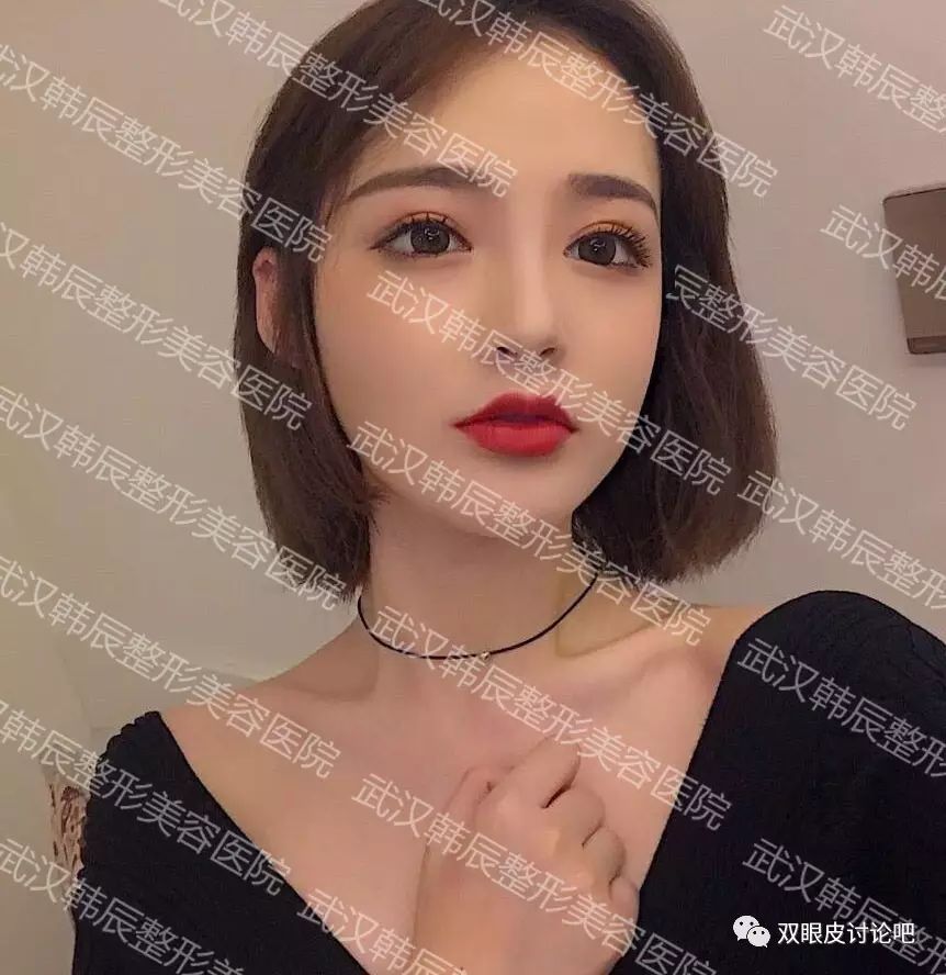 武汉韩式三点是永久的吗|武汉韩辰整形美容医院