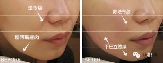 美容院如何选购美容仪器与注意事项